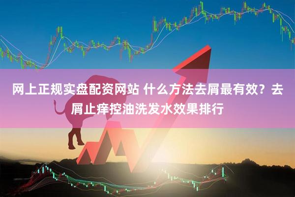 网上正规实盘配资网站 什么方法去屑最有效？去屑止痒控油洗发水效果排行